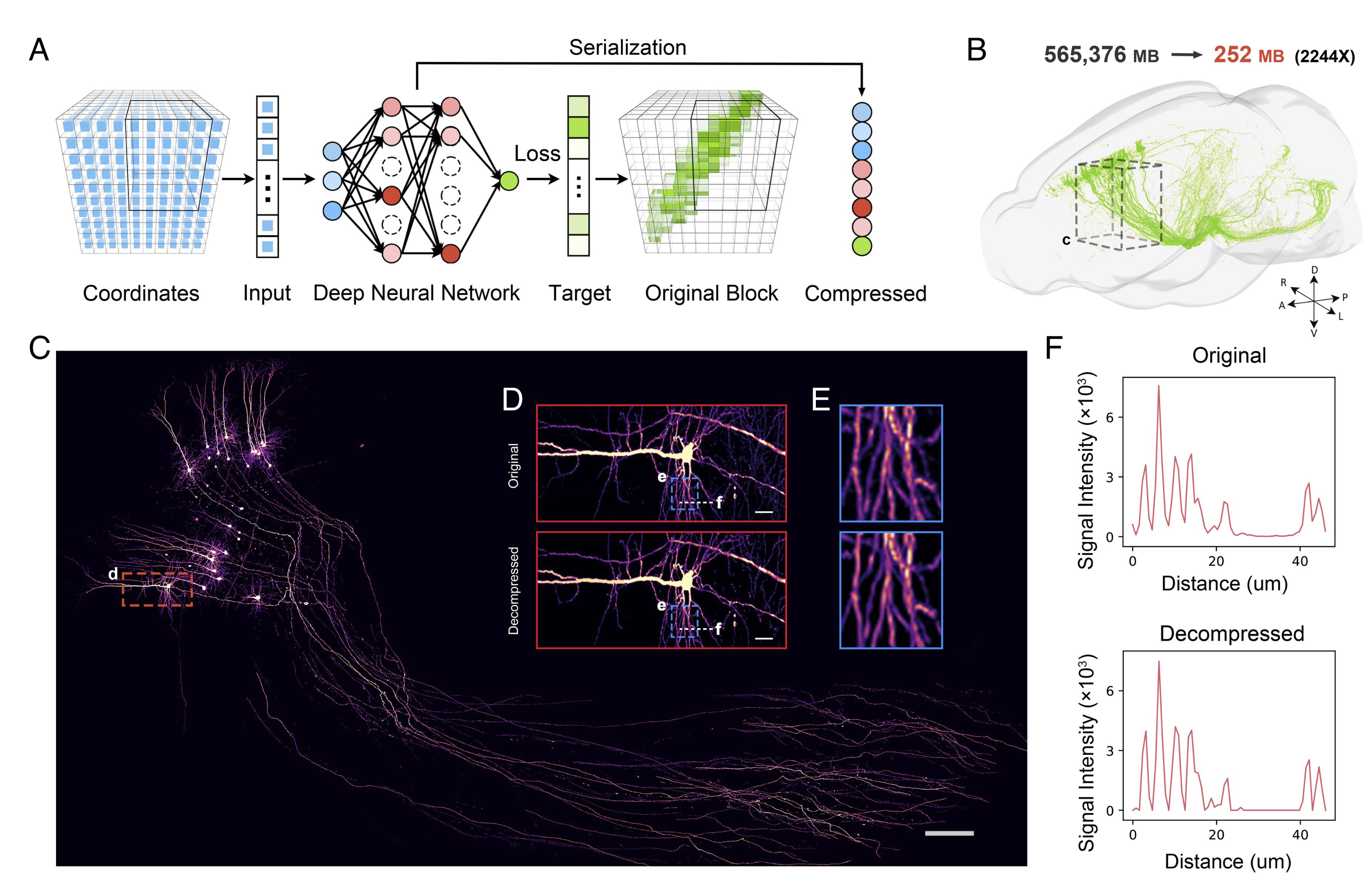 X-ray pathology localization