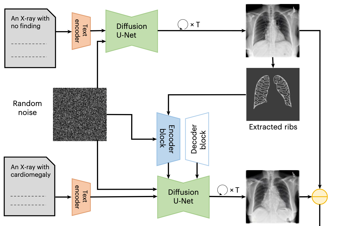 X-ray pathology localization